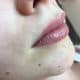 Permanent Make-up Lippen nachher