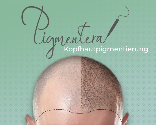 2kopfhautpigmentierung_fuer_startseite Kopfhautpigmentierung
